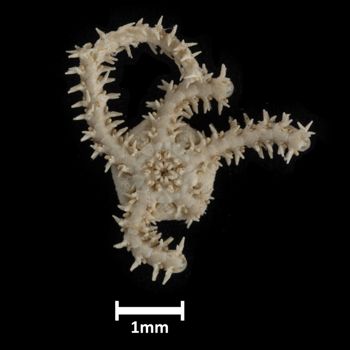 Media type: image;   Invertebrate Zoology OPH-4935 Description: Bottom up view of single ophiuroid specimen with a scale bar.;  Aspect: ventral